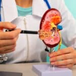 6 Habits to Get Rid of to Love Your Kidneys! You'll Notice the Change in No Time